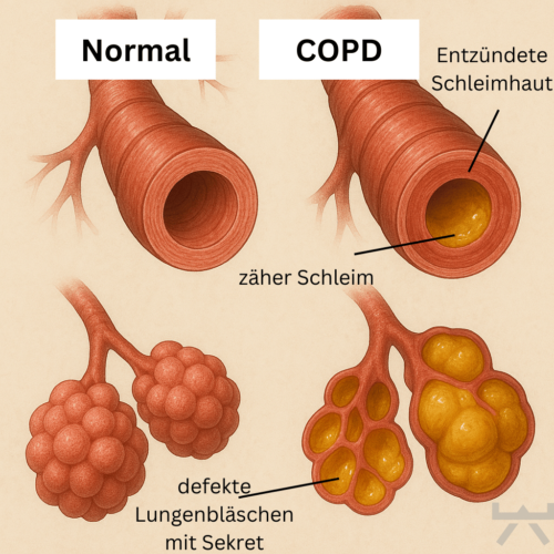 Schonende Ausdauerübung zur COPD-Stabilisierung, geeignet für Menschen aus Ennigerloh und Oelde.