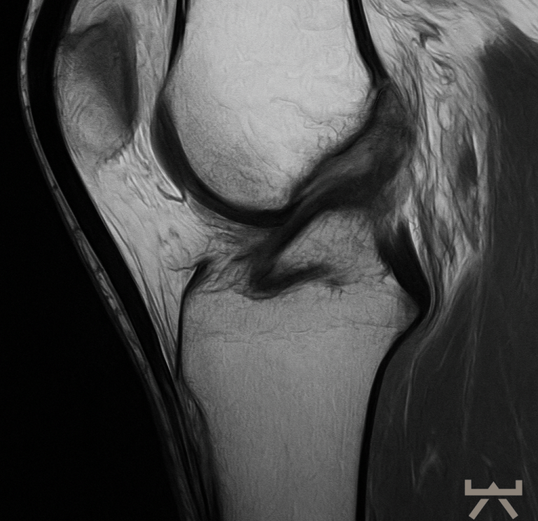 Aktive Reha-Übung zur Wiederherstellung von Kraft und Gelenkstabilität für Personen aus Neubeckum und Warendorf.