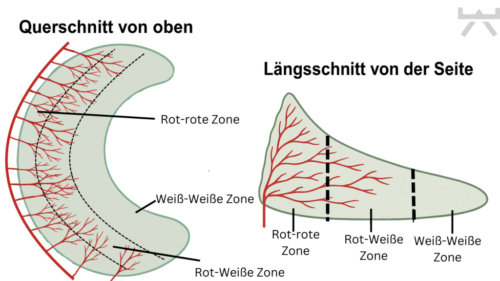 Gezieltes Krafttraining für stabilere Knie bei Meniskusproblemen, geeignet für Menschen aus Ennigerloh und Westkirchen.