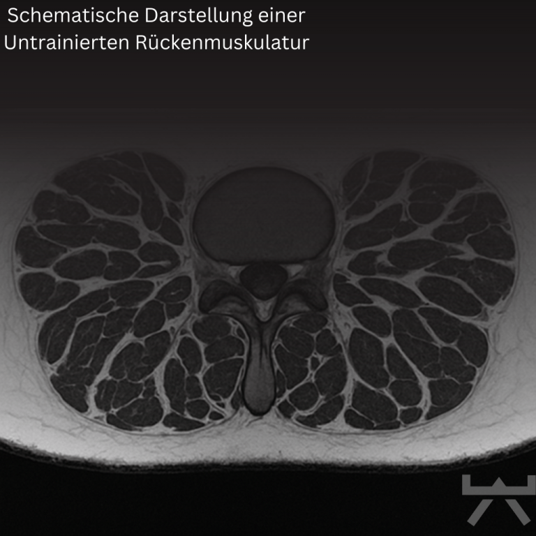 Übung zur Verbesserung von Balance und Kraft bei Sarkopenie im NEXCORE Training für Neubeckum und Warendorf.
