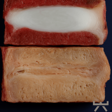 Therapeut zeigt aktive Behandlung bei Bandscheibenvorfall in der NEXCORE Physiotherapie Ennigerloh.