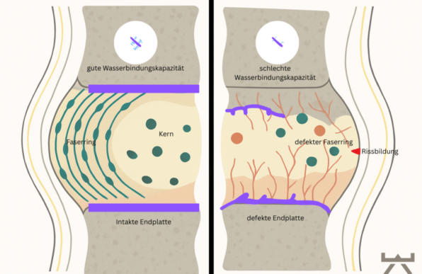 Alltagsbewegungen zur Entlastung der Bandscheiben, erklärt im NEXCORE Ennigerloh.
