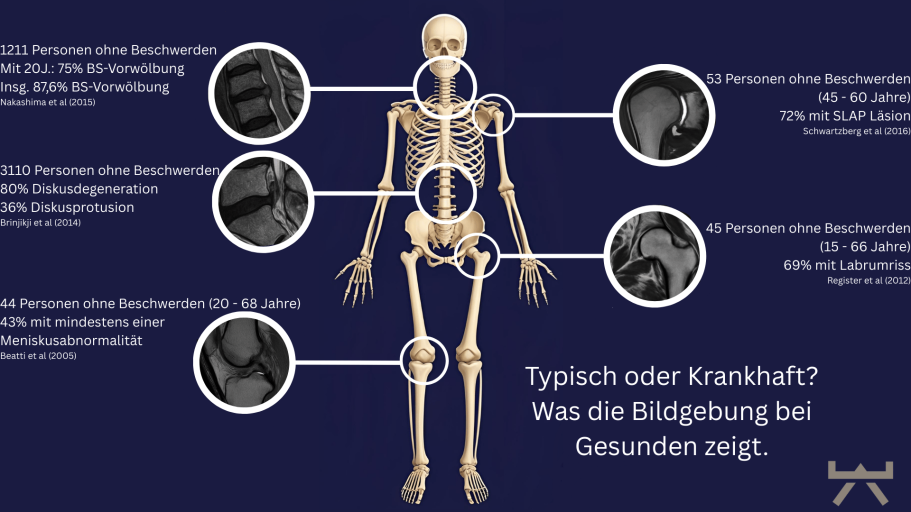 Beschwerdesenkung NEXCORE