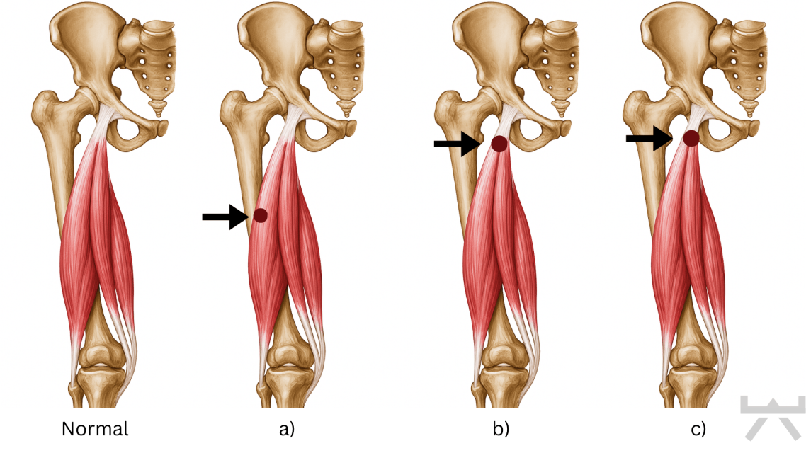 Gezielte Trainingssequenz zur behutsamen Steigerung der Muskelbelastung für Betroffene aus Ennigerloh und Oelde.
