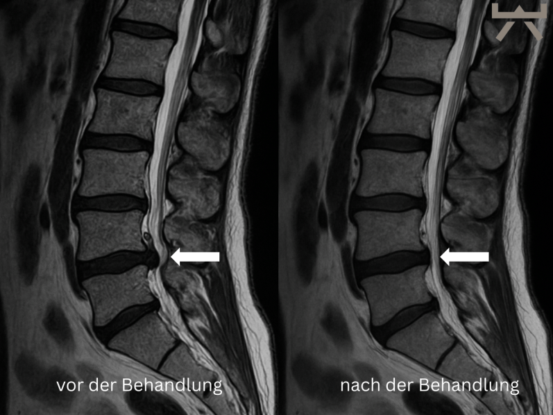 Training zur Verbesserung der Rumpfstabilität im NEXCORE Studio für Menschen aus Neubeckum.