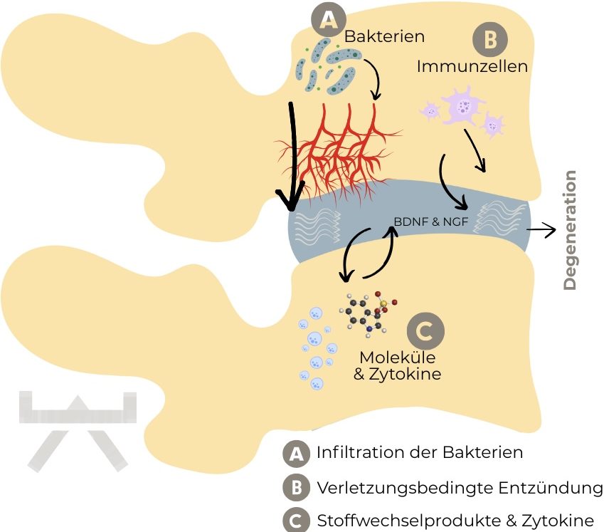 Aktives Rehatraining nach Bandscheibenvorfall in der NEXCORE Physiotherapie Ennigerloh.