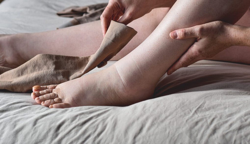 Physiotherapeutische Übung zur Entstauung und Verbesserung des Lymphflusses bei Lymphödem in der NEXCORE Physiotherapie Ennigerloh.