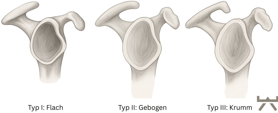 Ganzheitliche Trainingsübung zur Verbesserung der Schulterfunktion und Bewegungsfreiheit im NEXCORE Trainingsbereich Ennigerloh.